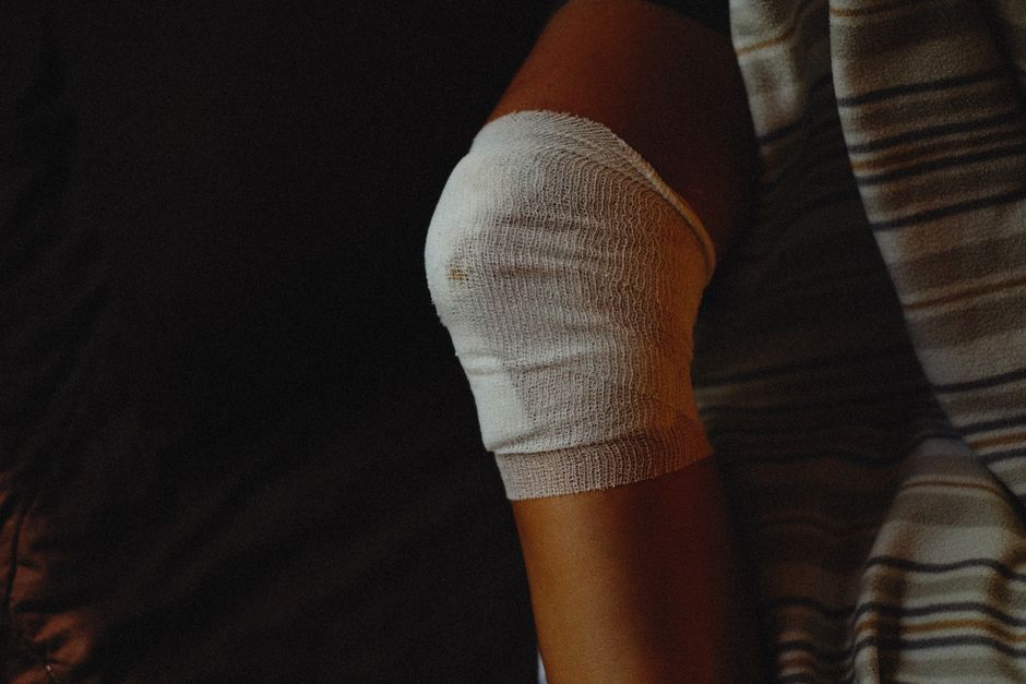 How Can I Tell If My Knee Swelling is Serious or Just Inflammation From Normal Activity?